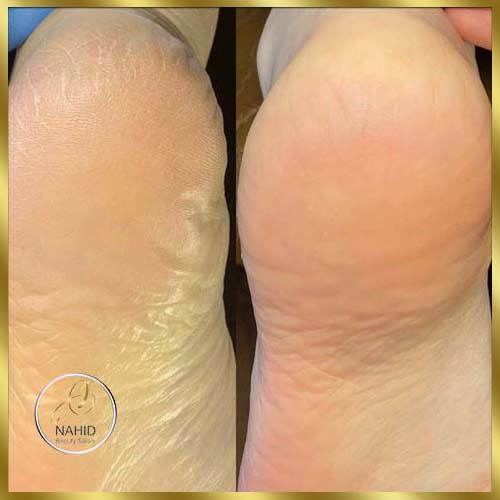 گالری پدیکور